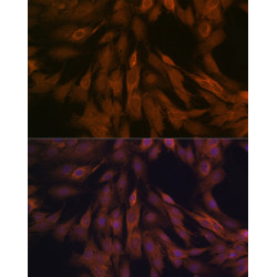ULK3 Rabbit mAb