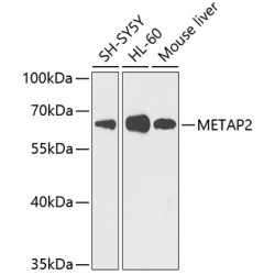 METAP2 Rabbit pAb