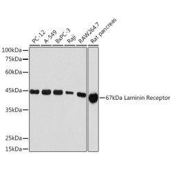 67kDa Laminin Receptor Rabbit mAb