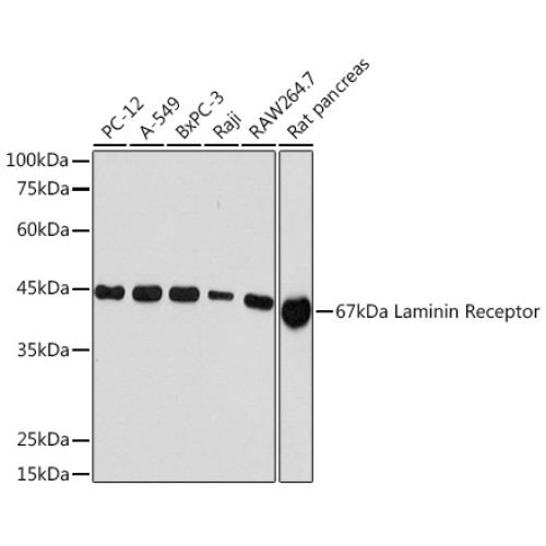 67kDa Laminin Receptor Rabbit mAb