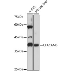 CEACAM6 Rabbit mAb