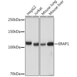 ERAP1 Rabbit mAb