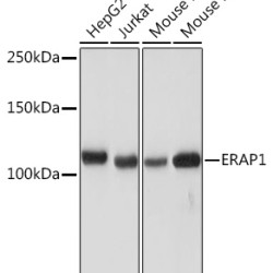 ERAP1 Rabbit mAb