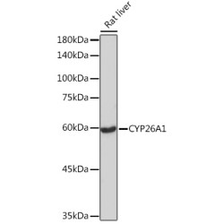 CYP26A1 Rabbit mAb