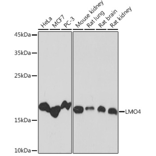 LMO4 Rabbit mAb
