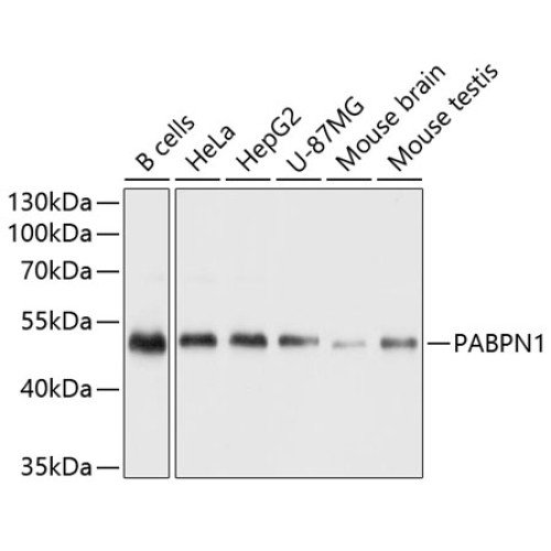 PABPN1 Rabbit pAb