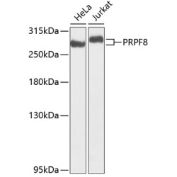 PRPF8 Rabbit pAb