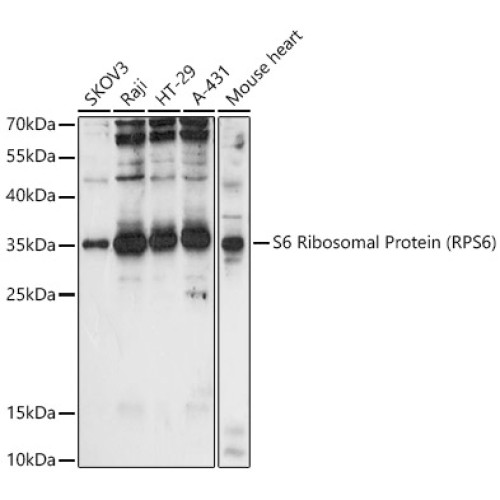 S6 Ribosomal Protein (RPS6) Rabbit pAb