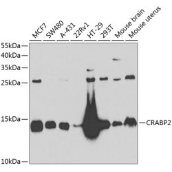 CRABP2 Rabbit pAb