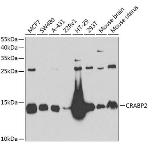 CRABP2 Rabbit pAb