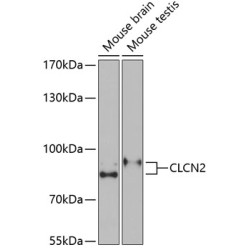 CLCN2 Rabbit pAb