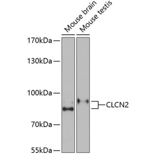 CLCN2 Rabbit pAb