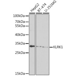 KLRK1 Rabbit pAb