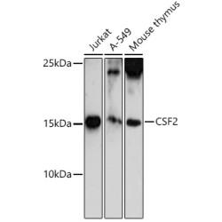 CSF2 Rabbit pAb