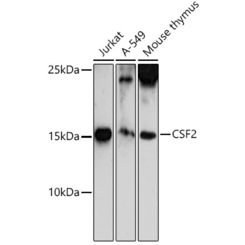 CSF2 Rabbit pAb