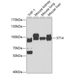 ST14 Rabbit pAb