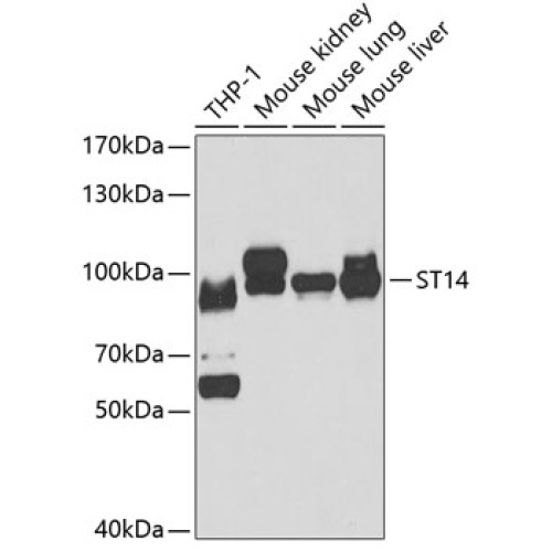 ST14 Rabbit pAb