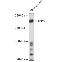 TRPM2 Rabbit pAb