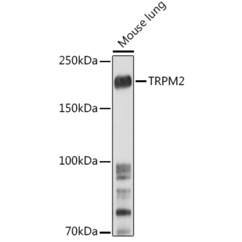 TRPM2 Rabbit pAb