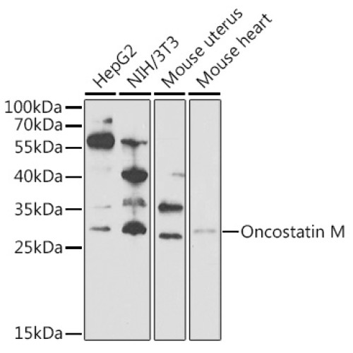 Oncostatin M Rabbit pAb