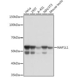 NAP1L1 Rabbit mAb