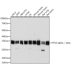 PP2A alpha/beta Rabbit mAb