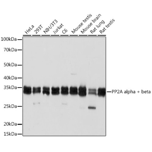 PP2A alpha/beta Rabbit mAb
