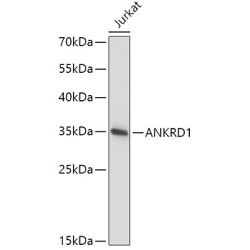 ANKRD1 Rabbit pAb