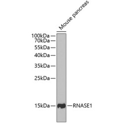 RNASE1 Rabbit pAb