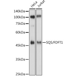 SQS/FDFT1 Rabbit pAb