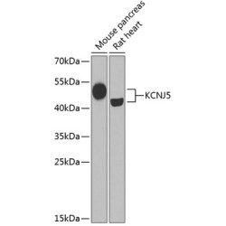KCNJ5 Rabbit pAb