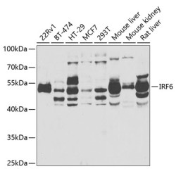 IRF6 Rabbit pAb