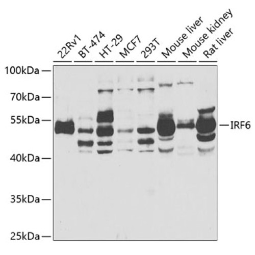 IRF6 Rabbit pAb