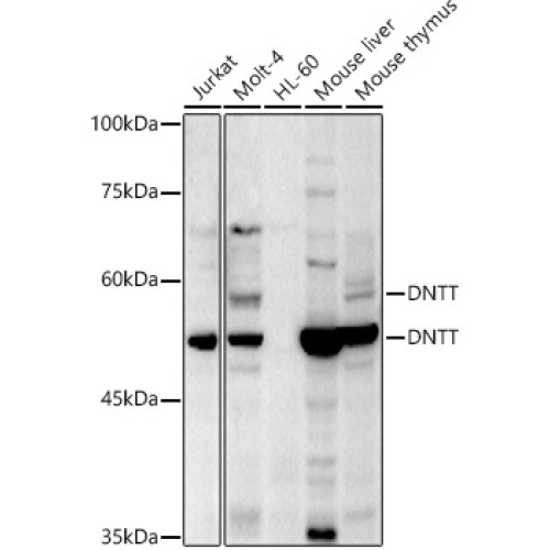 TdT Rabbit pAb