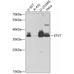 ETV7 Rabbit pAb