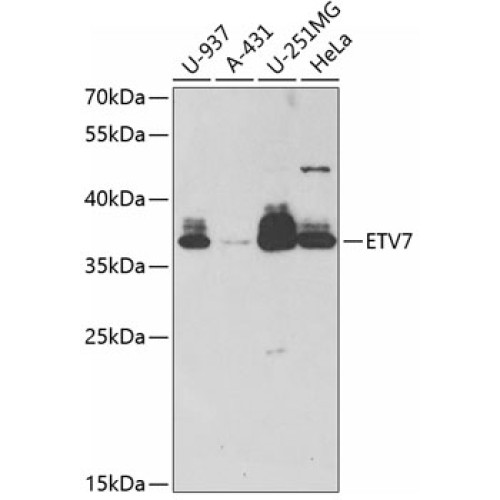 ETV7 Rabbit pAb
