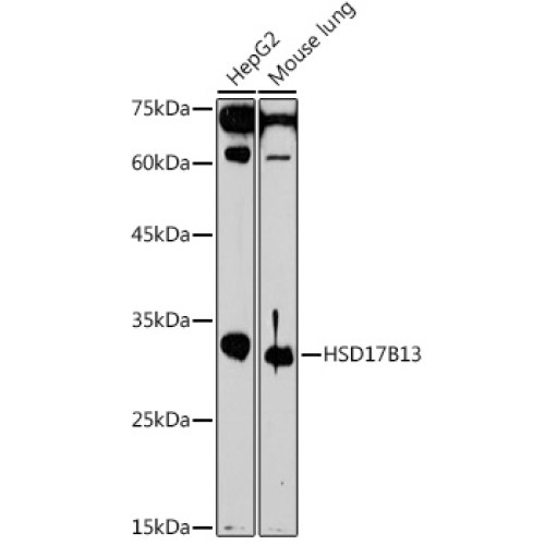 HSD17B13 Rabbit pAb
