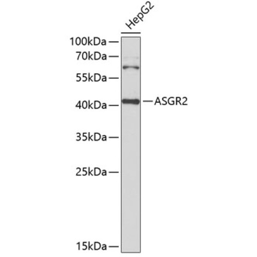 ASGR2 Rabbit pAb