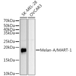 Melan-A/MART-1 Rabbit pAb