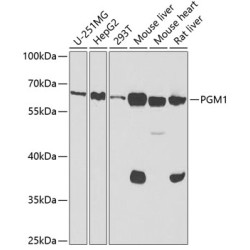 PGM1 Rabbit pAb