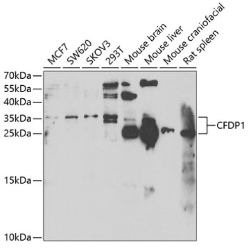 CFDP1 Rabbit pAb