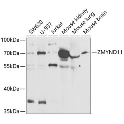 ZMYND11 Rabbit pAb