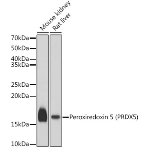 Peroxiredoxin 5 (PRDX5) Rabbit pAb