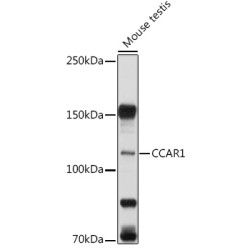 CCAR1 Rabbit pAb