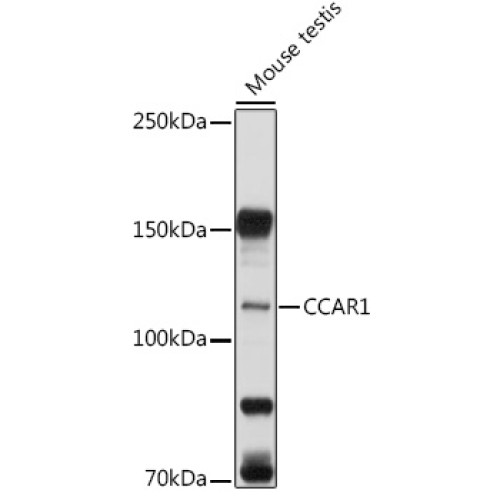 CCAR1 Rabbit pAb