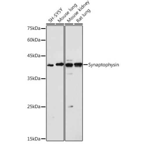 Synaptophysin Rabbit pAb