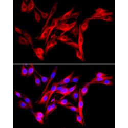 Fibroblast activation protein-α (FAP) Rabbit pAb