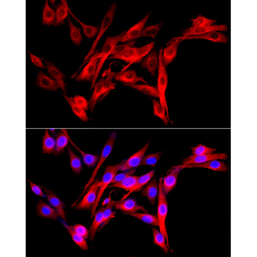 Fibroblast activation protein-α (FAP) Rabbit pAb