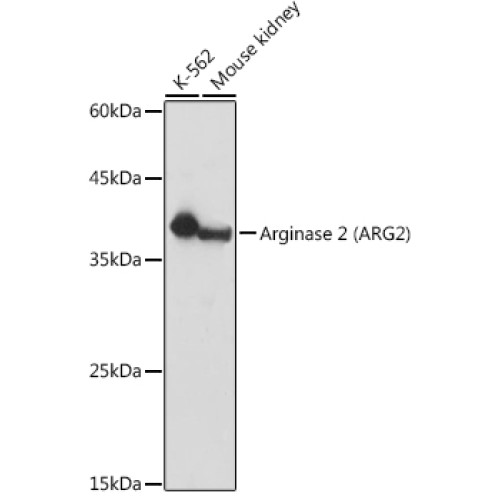 Arginase 2 (ARG2) Rabbit pAb