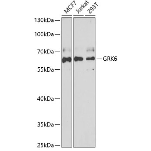 GRK6 Rabbit pAb